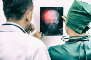 Legal Rights of Brain Injury Victims in San Diego: What You Need to Know